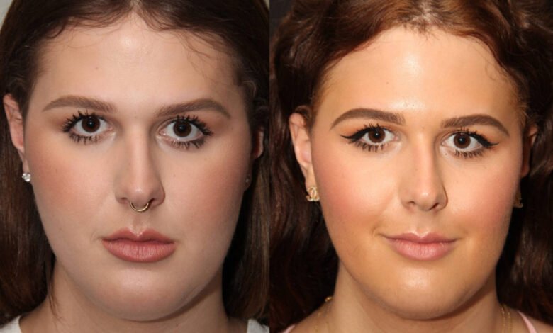 How to Lose Face Fat: Proven Methods to Try at Home