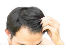 Different Ways to Stimulate Hair Growth for Men in 2023