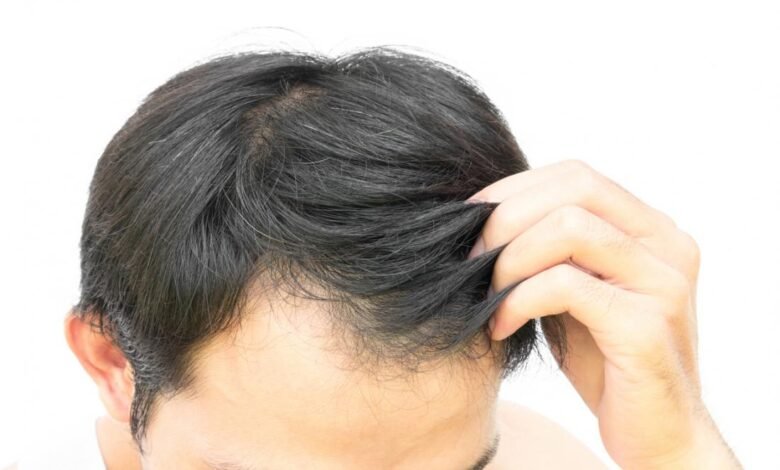 Different Ways to Stimulate Hair Growth for Men in 2023